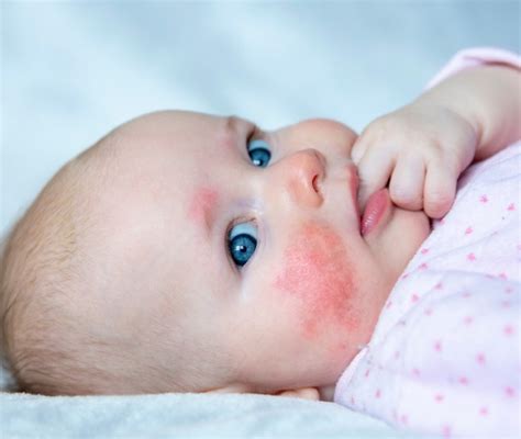 Pelle di un neonato pulita e sana