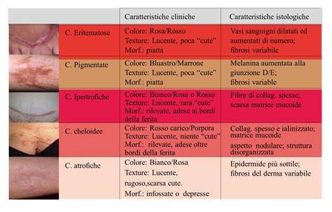 Schema comparativo delle tipologie di cicatrici post-crioterapia