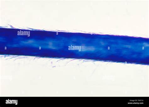 Micrografia di capelli sani