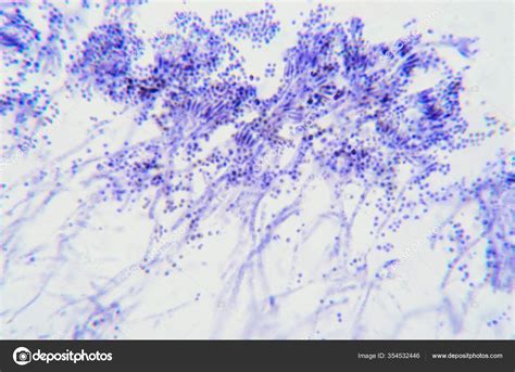 Illustrazione di Penicillium roqueforti al microscopio