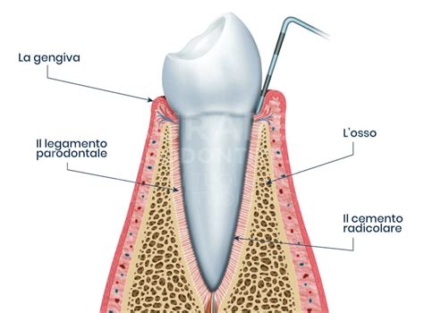 Diagramma che illustra il legamento parodontale che collega il cemento all'osso alveolare