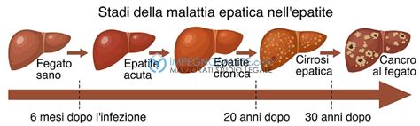 Schema del ciclo di trasmissione dell'epatite A