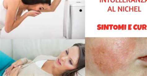 Schema comparativo sintomi allergia e intolleranza al nichel