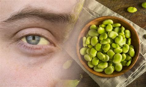 Schema che illustra il meccanismo del favismo e l'azione del G6PD