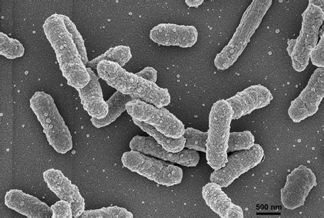 Microscopio elettronico a scansione di Yersinia pestis