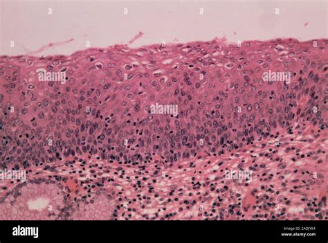 Micrografia di epitelio cervicale normale
