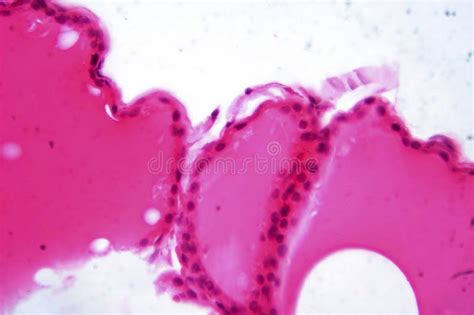Microscopio che mostra la struttura cellulare di una pianta con pigmenti rossi