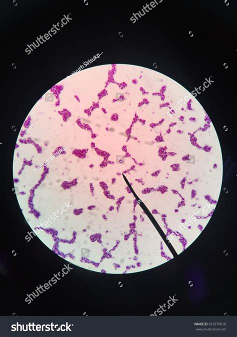 Clostridium botulinum al microscopio