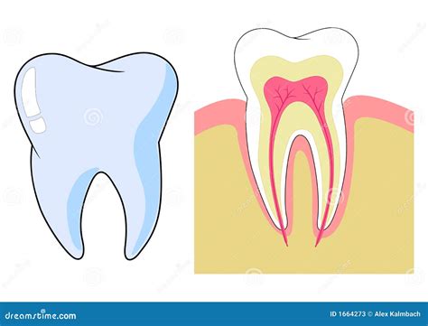 Illustrazione di un dente con una sottile crepa visibile