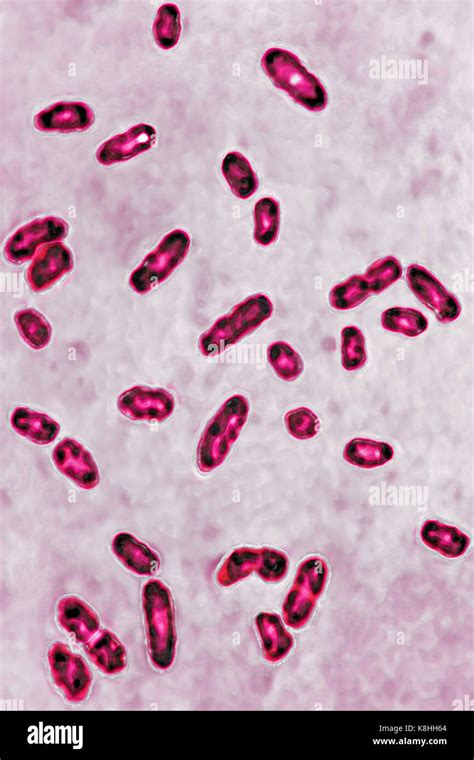 Micrografia di Yersinia pestis