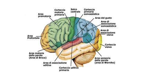 Schema di un cervello con aree evidenziate che indicano un ictus