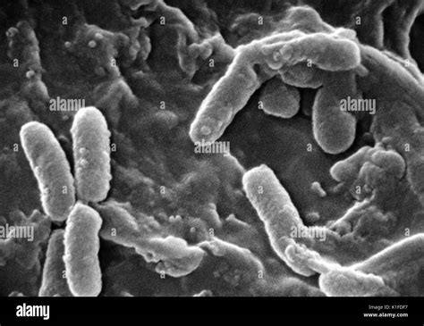 Batterio Pseudomonas fluorescens al microscopio